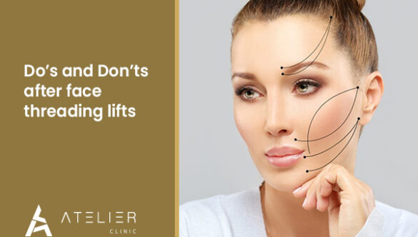 Do’s and Don’ts after Face Threading Lifts