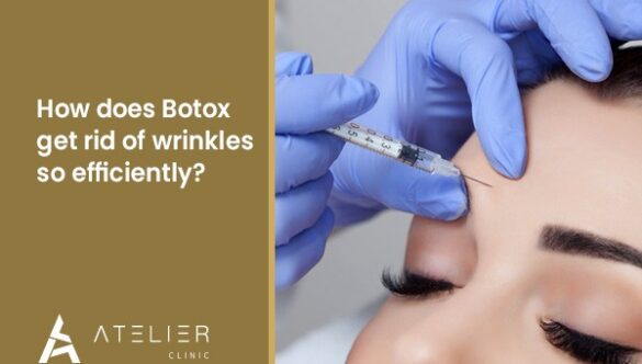 How does Botox get rid of wrinkles so efficiently?