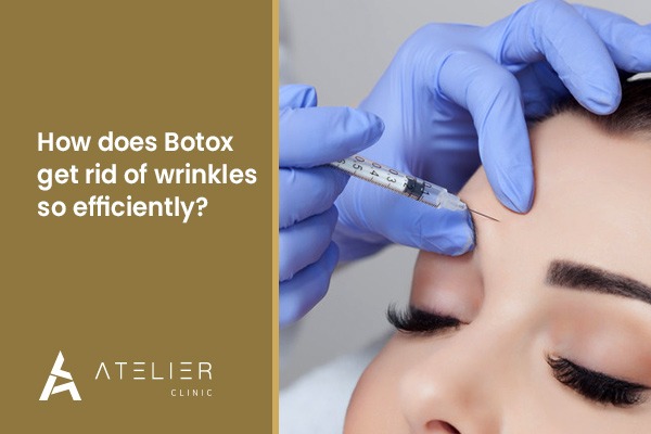 How does Botox get rid of wrinkles so efficiently?