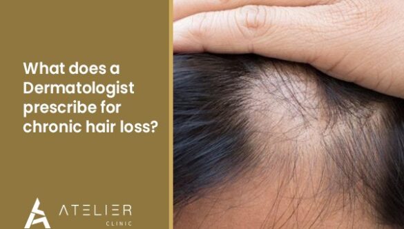 What does a dermatologist prescribe for chronic hair loss?