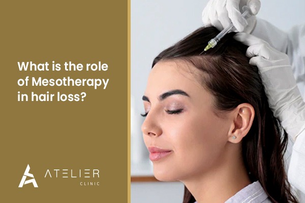 What is the role of Mesotherapy in hair loss?