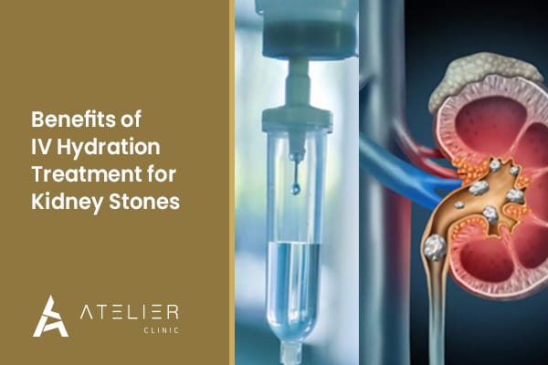 The Benefits of IV Hydration Treatment for Kidney Stones