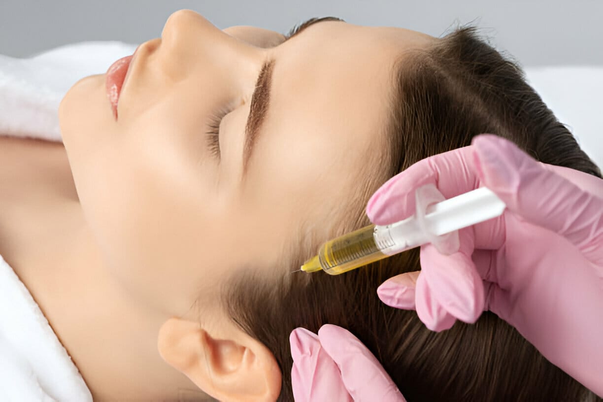 PRP Treatment in Dubai