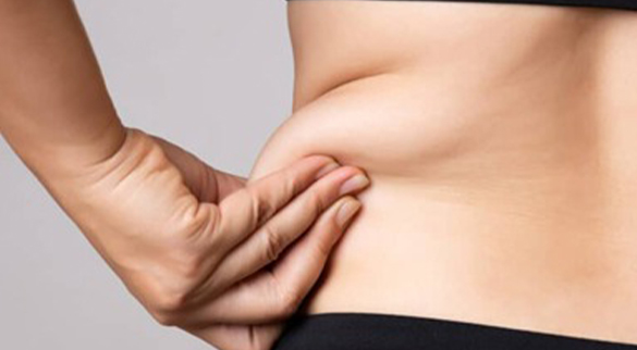 Opt for liposuction surgery Get rid of excess fat and improve your appearance